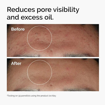Niacinamide Zinc Serum