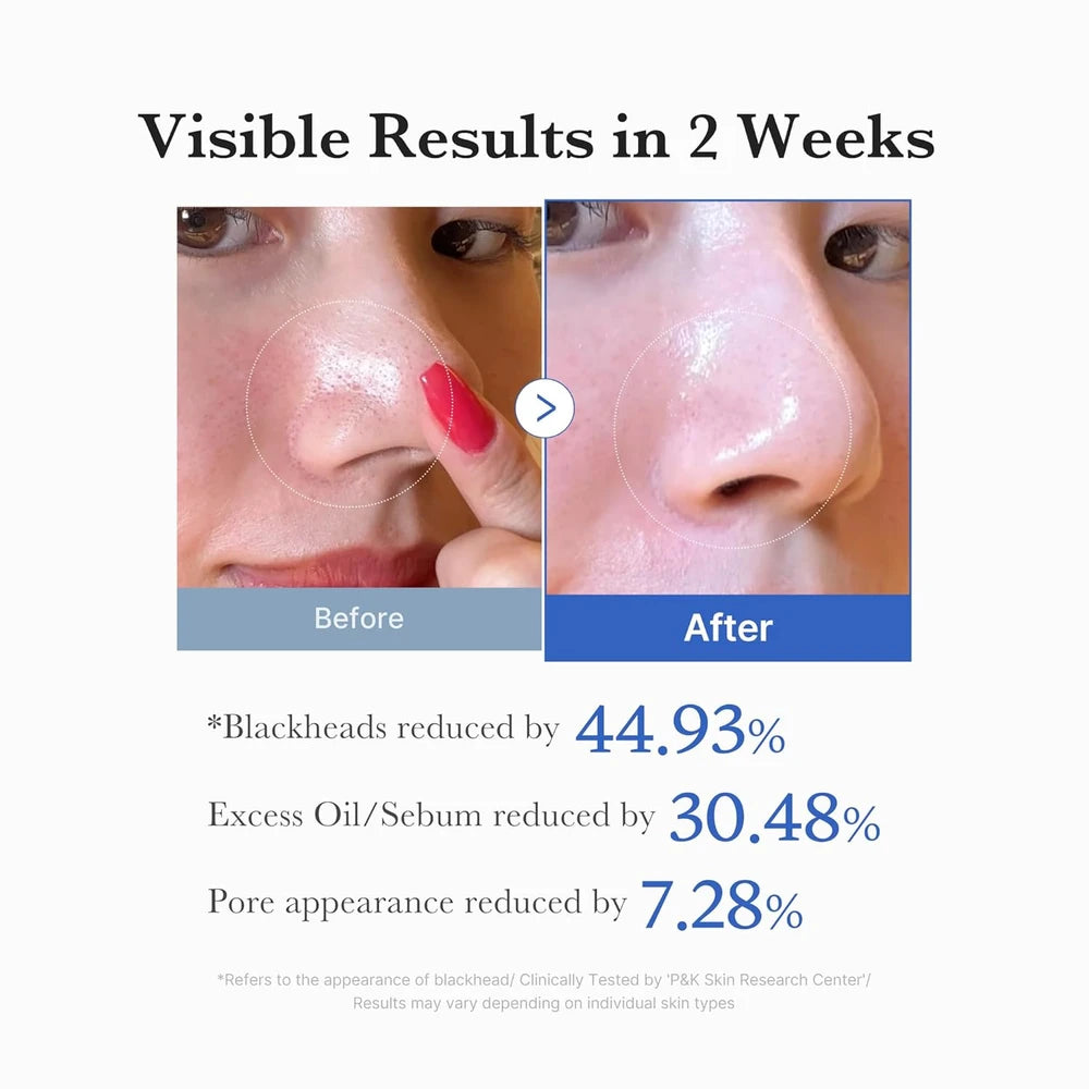 Medicube Zero Pore Pad 2.0